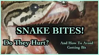 SNAKE BITES! | DO THEY HURT? | HOW TO AVOID GETTING BIT | BALL PYTHON BREEDER | PRECIOUS PYTHONS