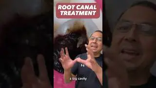 How Much is a Root Canal? EXPENSIVE | View Mobile Dental #shorts