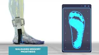 Walkasins: Restoring Balance in People with Peripheral Neuropathy.