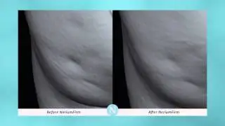 Nerium Firm