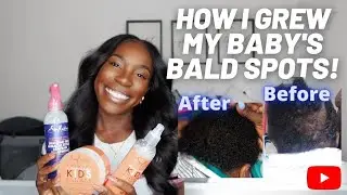 HOW I GREW MY BABY'S BALD SPOTS | HOW TO GROW BABY'S HAIR FAST | Black mommy vlogs | 2023