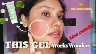 How To Soothe Skin Irretaion ✨|| Earth Rhythm Cica Gel ☘️|| How To Treat Skin Allergy ||