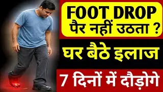 पैर उठता नहीं?(Foot Drop), पंजों का लकवा को अब घर बैठे ठीक करें|Drop Foot Exercises