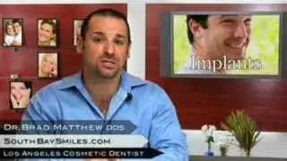 Los Angeles Cosmetic Dentist Tooth Implant