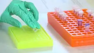 PCR og gel elektroforese