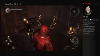 Anticles's Live PS4 Broadcast