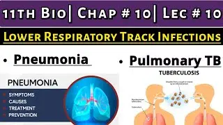 Lower Respiratory Tract Infections | Explain Pneumonia & Pulmonary Tuberculosis| 11th Bio| Chap # 10