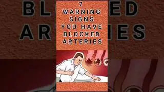 Warning signs you Have Blocked Arteries #shorts