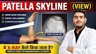 Patella Skyline view || Knee joint Radiography | Knee Skyline view 