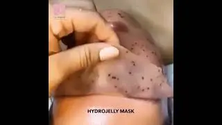 The KRISALYS Hydrojelly Mask