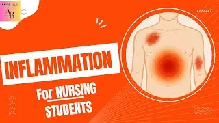 INFLAMMATION