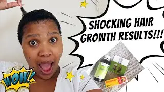 Grow Your Hair Fast with this Bergamont Treatment | Hairline repair remedy