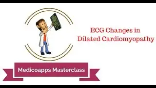 ECG Changes in Dialated Cardiomyopathy