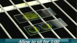 Staining Slides for AFB Detection