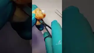 Cigarette filter before and after use!