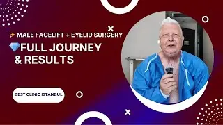 👉 Male Facelift & Eyelid Surgery in Istanbul | Full Patient Journey & Interview