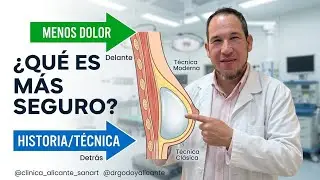 Implantes Mamarios: ¿Delante o Detrás del Músculo? Dr. Godoy explica
