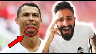 DARUM tr&auml;gt RONALDO jetzt KINNBART! 😂