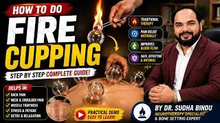 How to do Fire Cupping ||Complete Cupping Therapy Training | Dry, Fire & Wet Cupping Explained