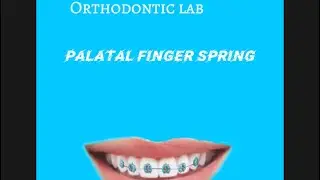 مختبر التقويم || palatal finger spring