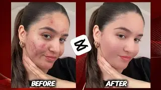 Face Smoothening / Retouching /Pimple Removal CapCut Tutorial
