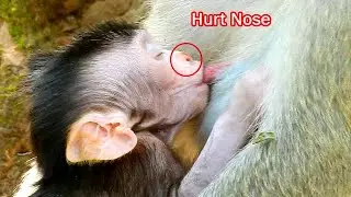Newborn Jody still got hurt on his nose , But Jody try to get tasty of full milk from mom chest