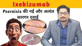 Copellor | Taltz | Ixekizumab Psoriasis की नवीनतम दवाई, इसके फायदे और नुकसान Arthritis में उपयोगिता