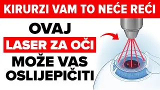 Nakon 65, ove 4 laserske operacije imaju 80% stopu neuspjeha, očni kirurg otkriva.