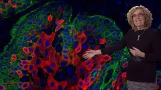 Элейн Фукс (Рокфеллер, HHMI) 3: Рак: перехват механизмов заживления ран, используемых стволовыми ...