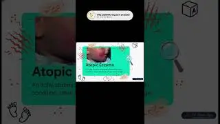 Atopic Dermatitis (Atopic Eczema) Explained: Clinical Features & Diagnosis