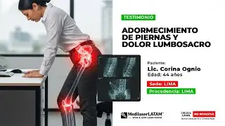Adormecimiento de piernas y dolor lumbosacro | TESTIMONIO | Medilaser LATAM