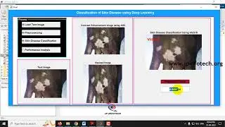 Skin Disease Classification using Deep Learning | MATLAB | Final Year IEEE Project