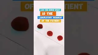 What is the laboratory request of the patient #cls #bloodtest #laboratory #mls #cls #medtechstudent