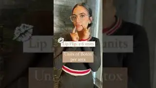 How Many Botox Units Do You Need? - Skin Vitality Canada - Call +1 (416) 969-9669
