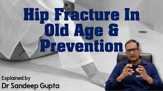 Hip Fracture in old age and prevention by Dr. Sandeep Gupta | Best Hip Surgeon, Fortis Mohali, India