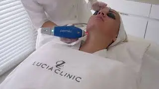 Gentle anti-aging laser treatment at Lucia Clinic Dubai