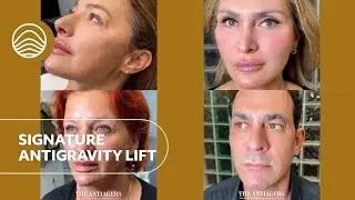 ✨&Tau;he Antiagers Signature Antigravity Lift : H &nu;έ&alpha; &delta;&iota;ά&sigma;&tau;&alpha;&sigma;&eta; &tau;&eta;&sigmaf; &Alpha;&nu;&alpha;&nu;έ&omega;&sigma;&eta;&sigmaf;- Showreel