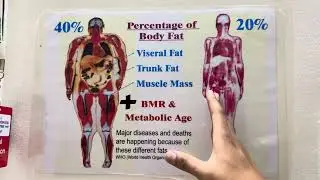 Body Fat types | Major disease | Weight Loss  