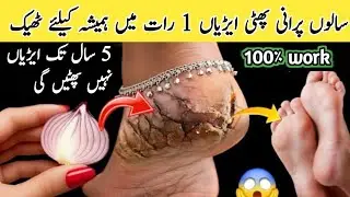 Hands feet repair cream | DIY hand & feet bleach | Hand whitening | Cracked Heels Repair Overnight👣