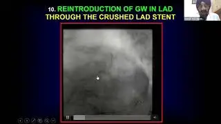 Dr. D. S. Gambhir - Step-by-step Approach for DK Crush