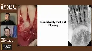 How to navigate CBCT in Endo