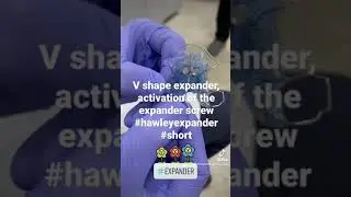 V shape #expander activation, expanding #hawley expander screw #short