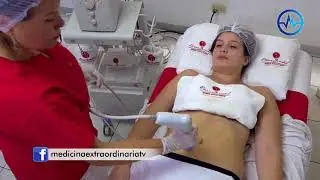 LIPO SIN CIRUGIA 💖 RADIOFRECUENCIA, ULTRASONIDO Y ONDAS DE CHOQUE 🧡 ETERNA JUVENTUD CLÍNICA