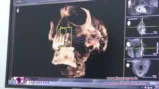 Sirona's German Cone Beam CT Scan Machine for the entire FACE - 2