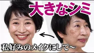 【レーザーで消したはずのシミが大きく…】私に似合うメイクが知りたいの