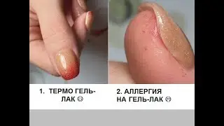 Аллергия на гель-лак/термо гель-лак