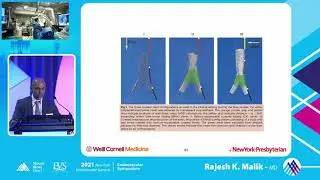 CERAB vs  Endografts Where Do We Stand - Rajesh K  Malik, MD