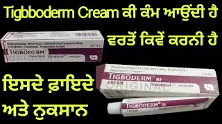 Tigboderm Cream ਕੀ ਕੰਮ ਆਉਂਦੀ ਹੈ। Tigboderm Cream Uses In Punjabi