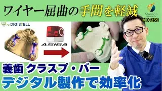 【パーシャルデンチャー】義歯のクラスプバーをCADソフトで簡単設計して3Dプリント【ディジステル】