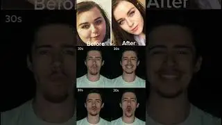 30 Sec Face Workout That Transforms Your Jawline & Cheeks FAST 🗿#glowup #faceyoga #jawline #viral